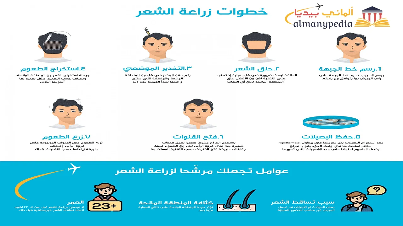 تكلفة-زراعة-الشعر-في-برلين