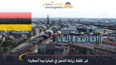 زراعة-الشعر-في-هامبورغ