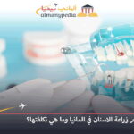 زراعة الأسنان في برلين